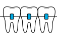 Brackets
